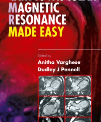 Cardiovascular Magnetic Resonance Made Easy