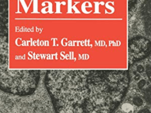 Cellular Cancer Markers by Carleton T. Garrett